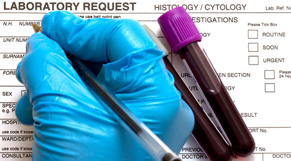 Kidney Health Screening
